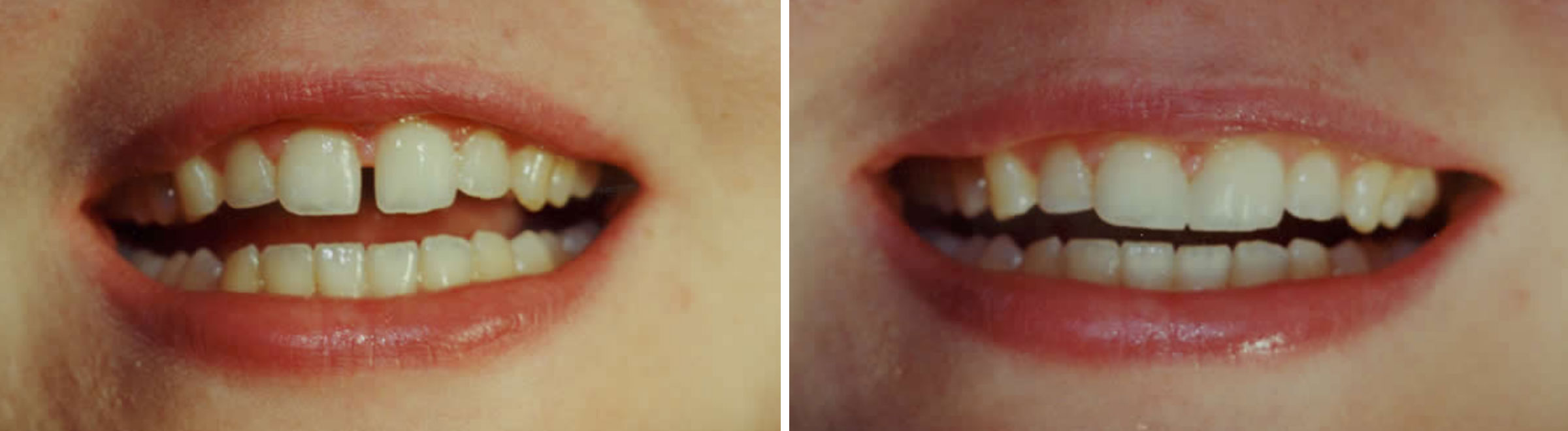 before and after 12