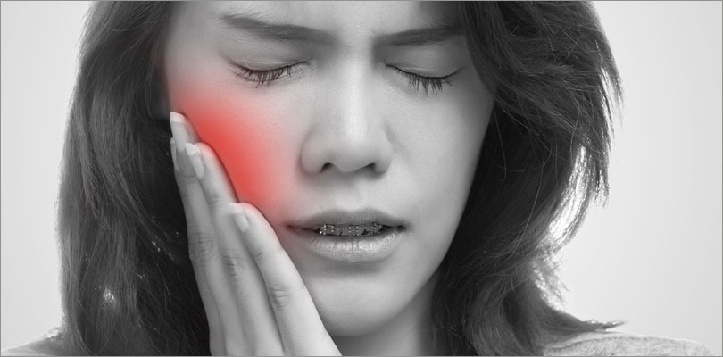 Tooth Extractions