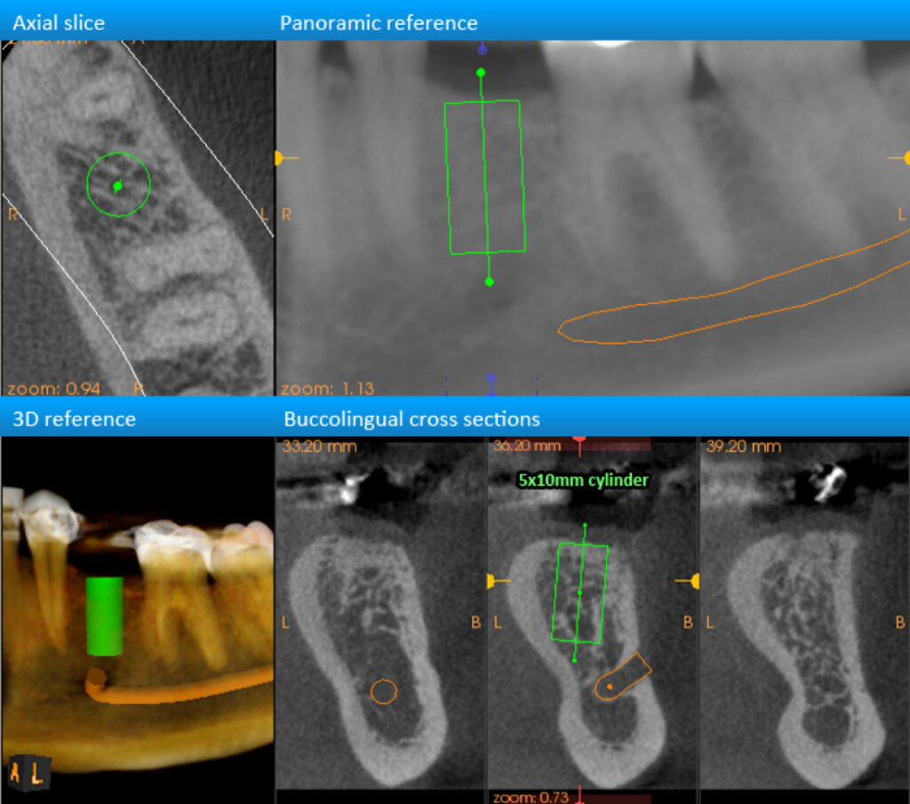 Xray