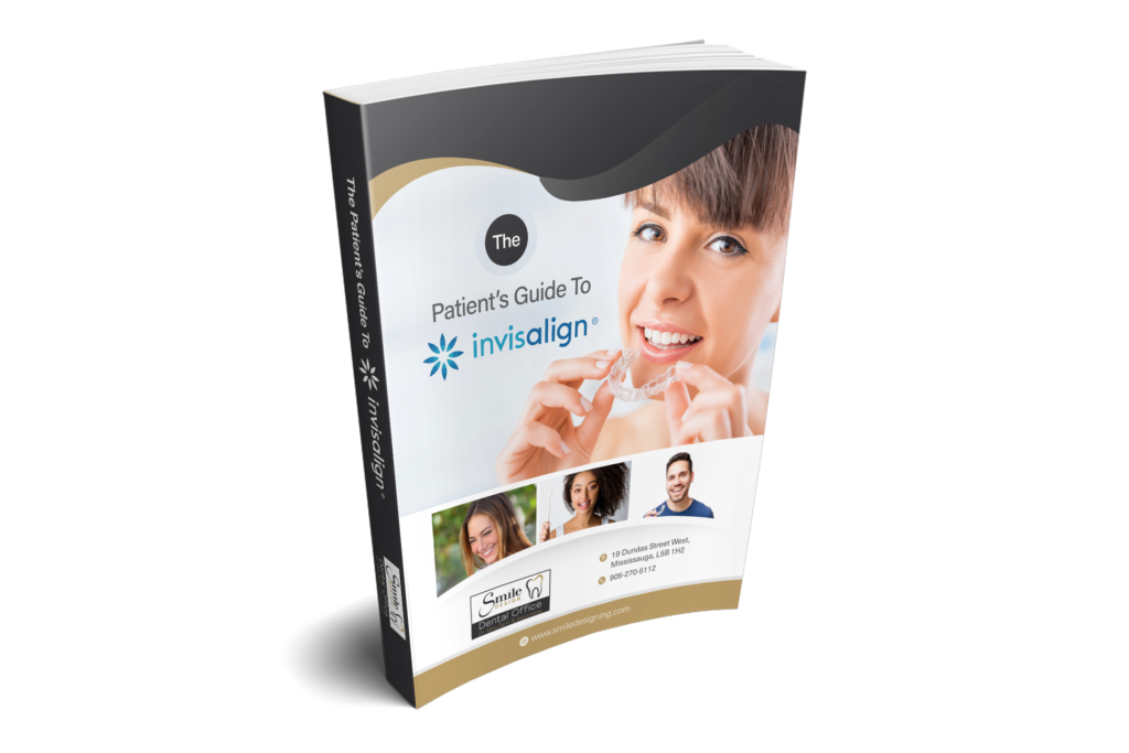 Invisalign-Guide